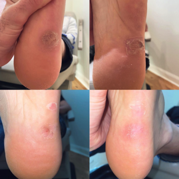 before and after treatment image